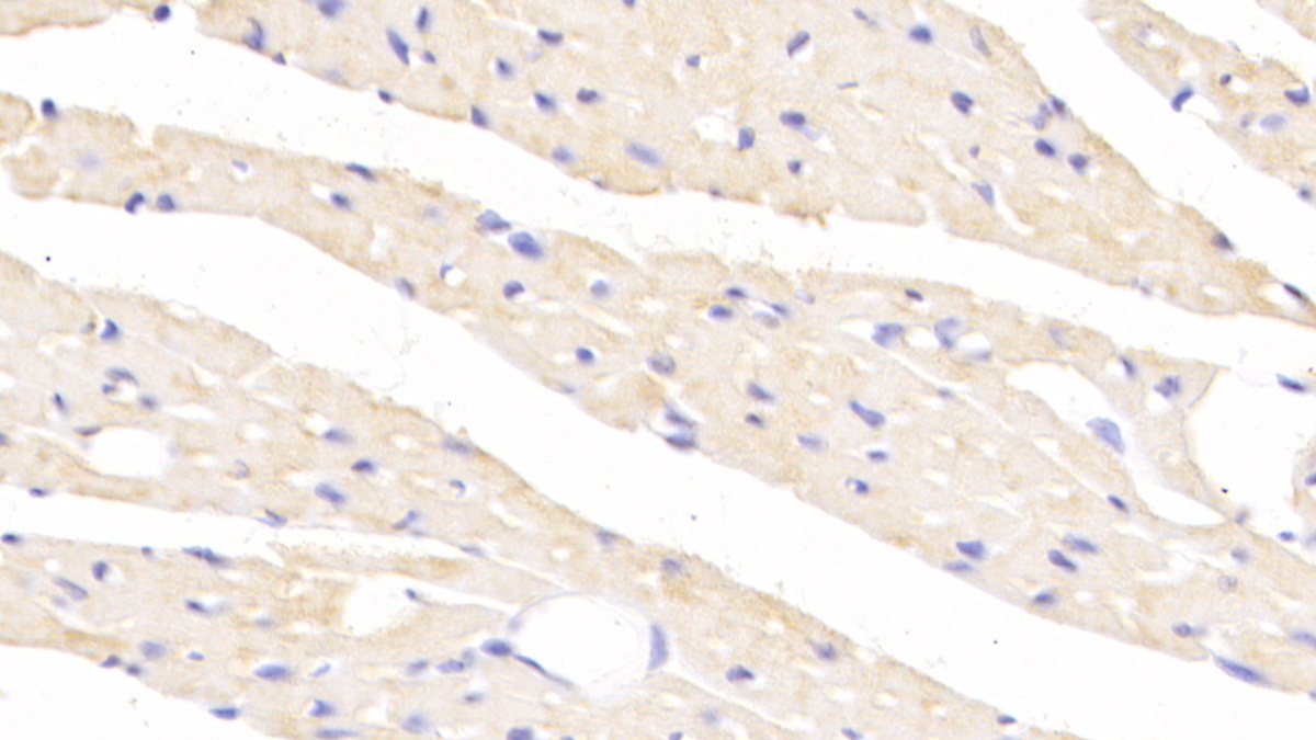 Polyclonal Antibody to Tumor Necrosis Factor Ligand Superfamily, Member 12 (TNFSF12)