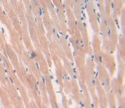 Polyclonal Antibody to Calcineurin Like Phosphoesterase Domain Containing Protein 1 (CPPED1)