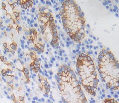 Polyclonal Antibody to Gibbon Ape Leukemia Virus Receptor 1 (GLVR1)