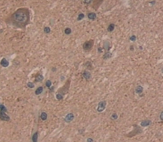 Polyclonal Antibody to B-Cell CLL/Lymphoma 11A (Bcl11A)