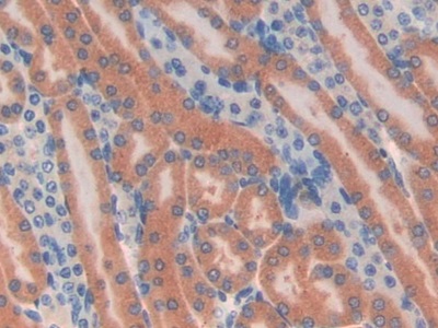 Polyclonal Antibody to Tubulin Delta (TUBd)