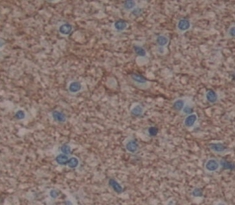 Polyclonal Antibody to Interleukin 20 Receptor Alpha (IL20Ra)