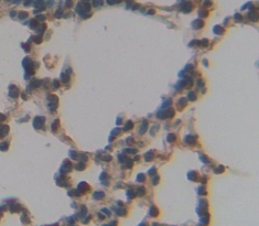 Polyclonal Antibody to Sirtuin 7 (SIRT7)