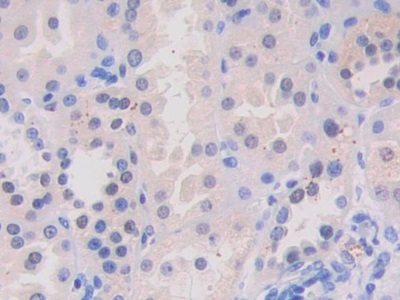 Polyclonal Antibody to Vav 3 Oncogene (VAV3)