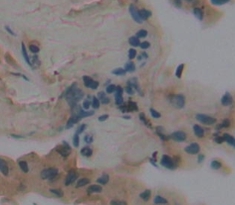 Polyclonal Antibody to Fatty Acid Desaturase 3 (FADS3)