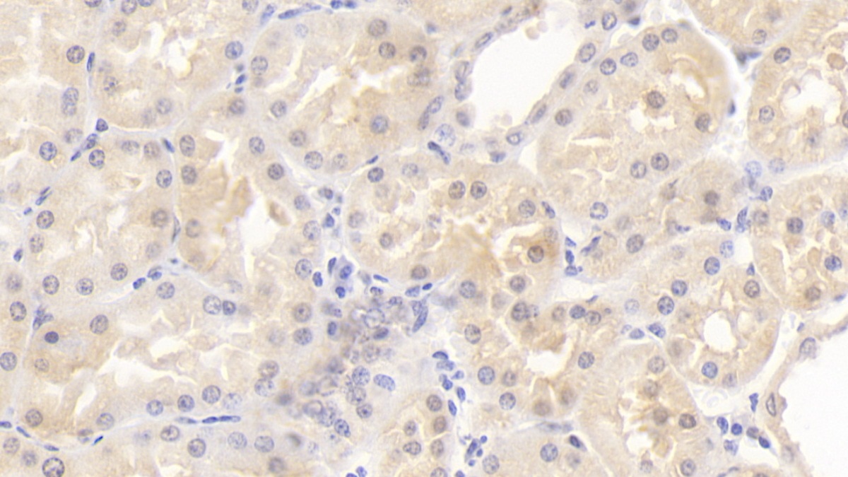 Polyclonal Antibody to Metastasis Associated Protein 2 (MTA2)