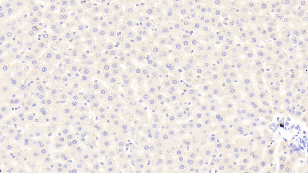 Polyclonal Antibody to Tumor Necrosis Factor Alpha Induced Protein 3 Interacting Protein 2 (TNIP2)