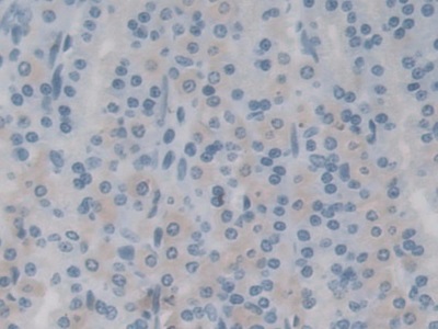 Polyclonal Antibody to Transient Receptor Potential Cation Channel Subfamily M, Member 7 (TRPM7)