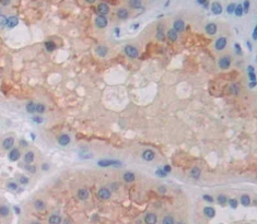 Polyclonal Antibody to Epithelial Stromal Interaction 1, Breast (EPSTI1)
