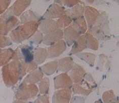 Polyclonal Antibody to Protein Kinase, AMP Activated Gamma 3 (PRKAg3)