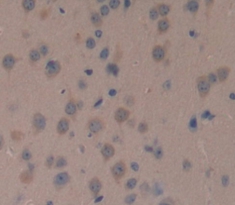 Polyclonal Antibody to Nephroblastoma Overexpressed Gene (NOV)