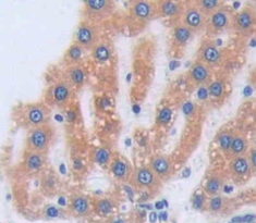 Polyclonal Antibody to Uroporphyrinogen Decarboxylase (UROD)