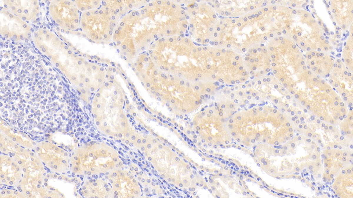 Polyclonal Antibody to Lipocalin 12 (LCN12)
