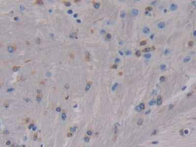Polyclonal Antibody to Phosphoprotein Associated With Glycosphingolipid Microdomains 1 (PAG1)