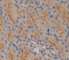 Polyclonal Antibody to Solute Carrier Family 30, Member 6 (SLC30A6)