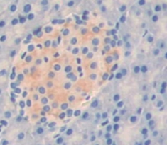 Polyclonal Antibody to Torsin 3A (TOR3A)