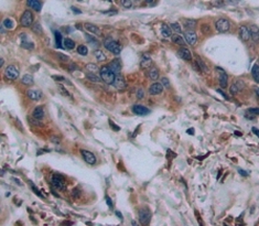 Polyclonal Antibody to Breast Cancer Anti-Estrogen Resistance 3 (BCAR3)
