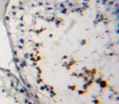 Polyclonal Antibody to Protamine 2 (PRM2)