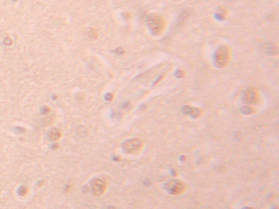 Polyclonal Antibody to Phosphohistidine Phosphatase 1 (PHPT1)