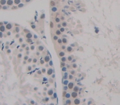 Polyclonal Antibody to Never In Mitosis Gene A Related Kinase 2 (NEK2)