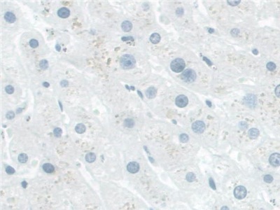 Polyclonal Antibody to NAD Kinase (NADK)