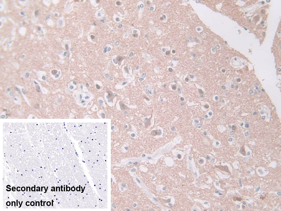 Polyclonal Antibody to Guanine Deaminase (GDA)