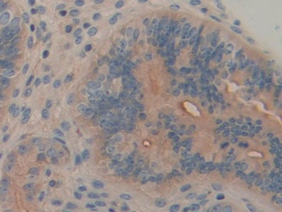 Polyclonal Antibody to Feline Sarcoma Oncogene (FES)