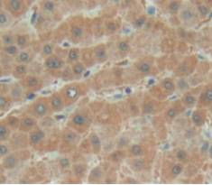 Polyclonal Antibody to Biotinidase (BTD)