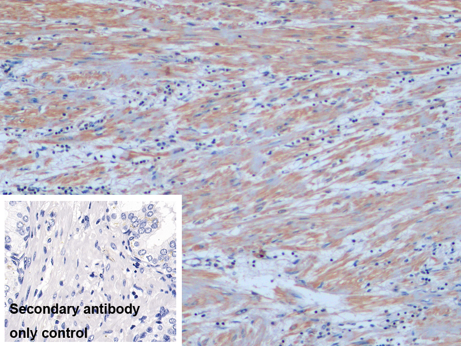 Polyclonal Antibody to Alpha-Methylacyl Coenzyme A Racemase (aMACR)