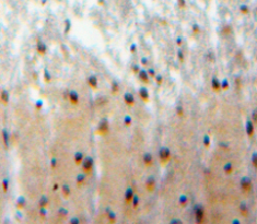Polyclonal Antibody to F-Box And WD Repeat Domain Containing Protein 7 (FBXW7)