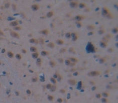 Polyclonal Antibody to V-Myc Myelocytomatosis Viral Oncogene Homolog 1, Lung Carcinoma Derived (MYCL1)