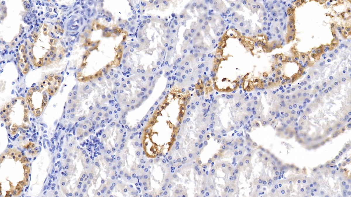 Polyclonal Antibody to Kidney And Brain Protein (KIBRA)