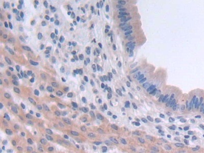 Polyclonal Antibody to Tsukushin (TSK)