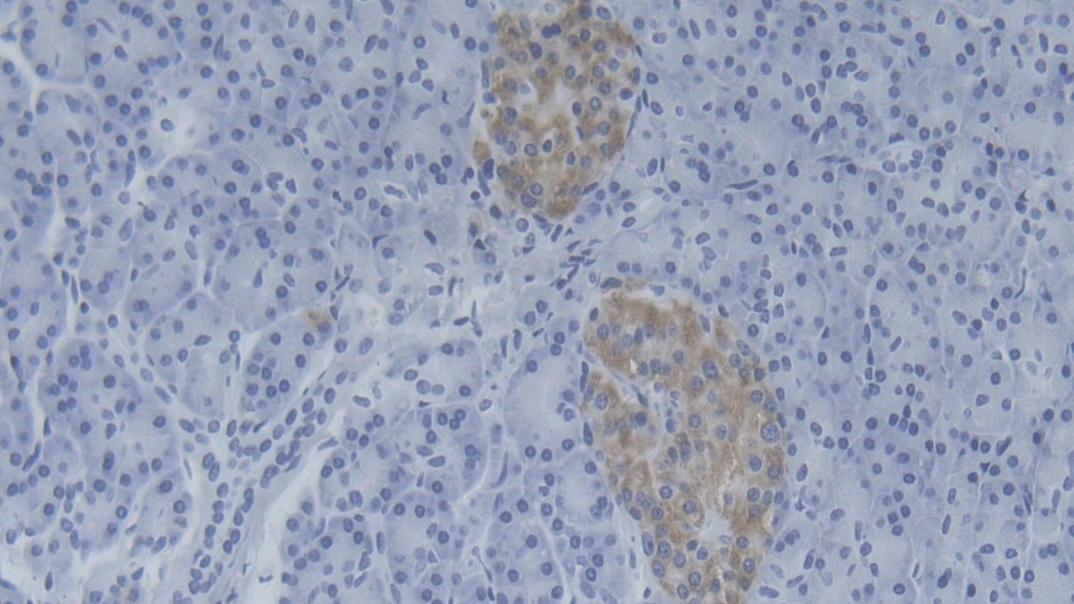 Polyclonal Antibody to Normal Mucosa Of Esophagus Specific 1 (NMES1)