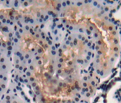 Polyclonal Antibody to Amy1 Associated Protein Expressed In Testis (AAT1)