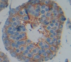 Polyclonal Antibody to A Disintegrin And Metalloprotease 5 (ADAM5)