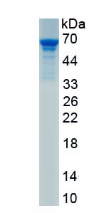 Active Connective Tissue Growth Factor (CTGF)