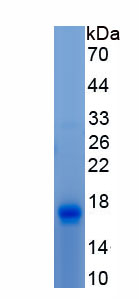 Active Brain Derived Neurotrophic Factor (BDNF)