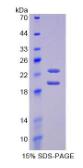 Active Ciliary Neurotrophic Factor (CNTF)