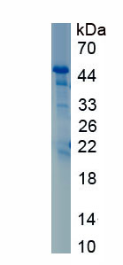 Active Fibronectin (FN)