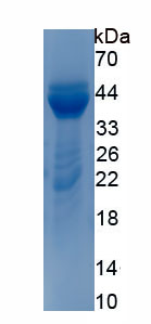Active Insulin Like Growth Factor 1 (IGF1)
