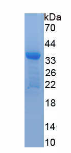 Active Interleukin 4 (IL4)