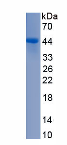 Active Interleukin 5 (IL5)