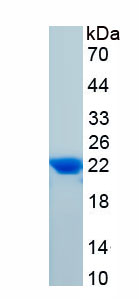 Active Colony Stimulating Factor 1, Macrophage (MCSF)