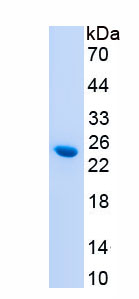 Active Oncostatin M (OSM)