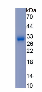 Active Superoxide Dismutase 3, Extracellular (SOD3)