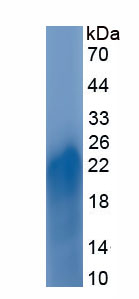 Active Carcinoembryonic Antigen (CEA)