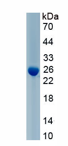 Active Protease, Serine 1 (PRSS1)