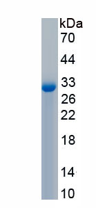 Active Elastin Microfibril Interface Located Protein 1 (EMILIN1)