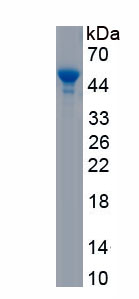 Active Neuropilin 1 (NRP1)